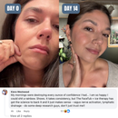 The FaceTub - Full Kit